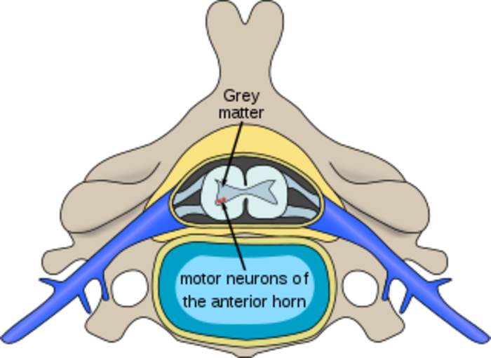 Motor neuron diseases